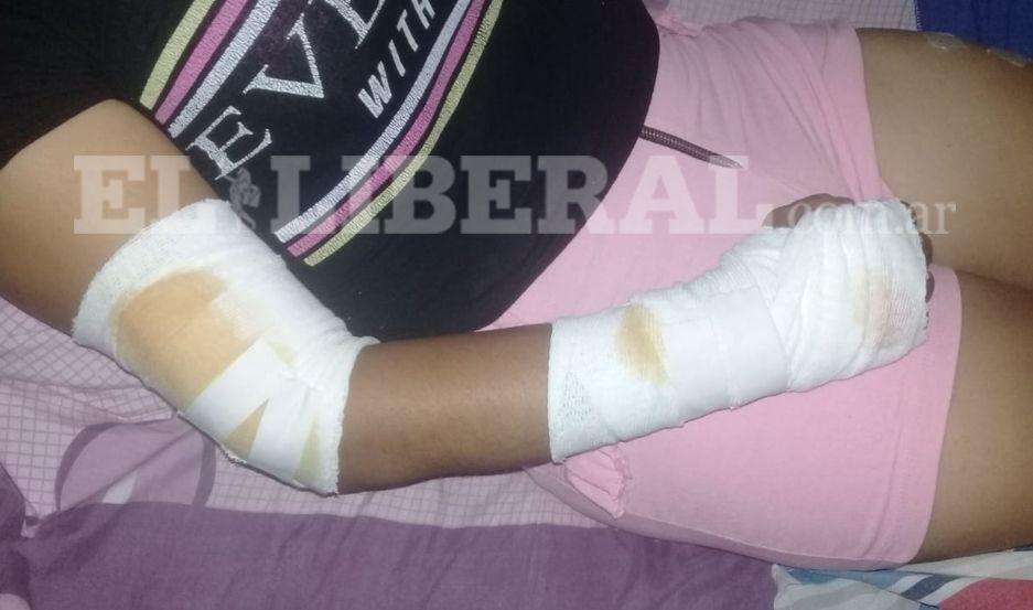 La joven terminó con varias heridas en piernas y brazos