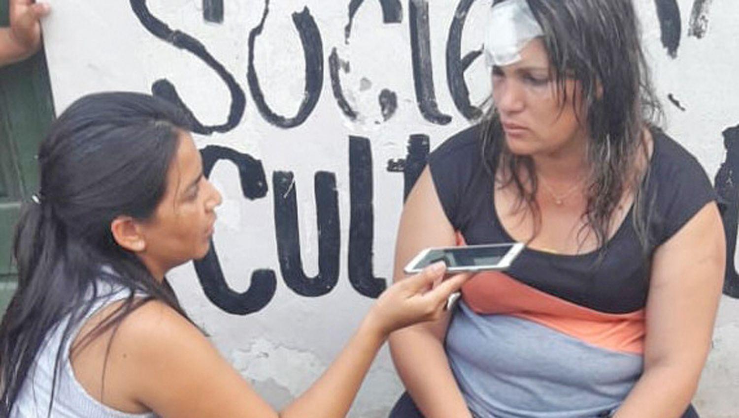 Prisioacuten preventiva para  el irracional sujeto que atacoacute con adoquiacuten a su ex