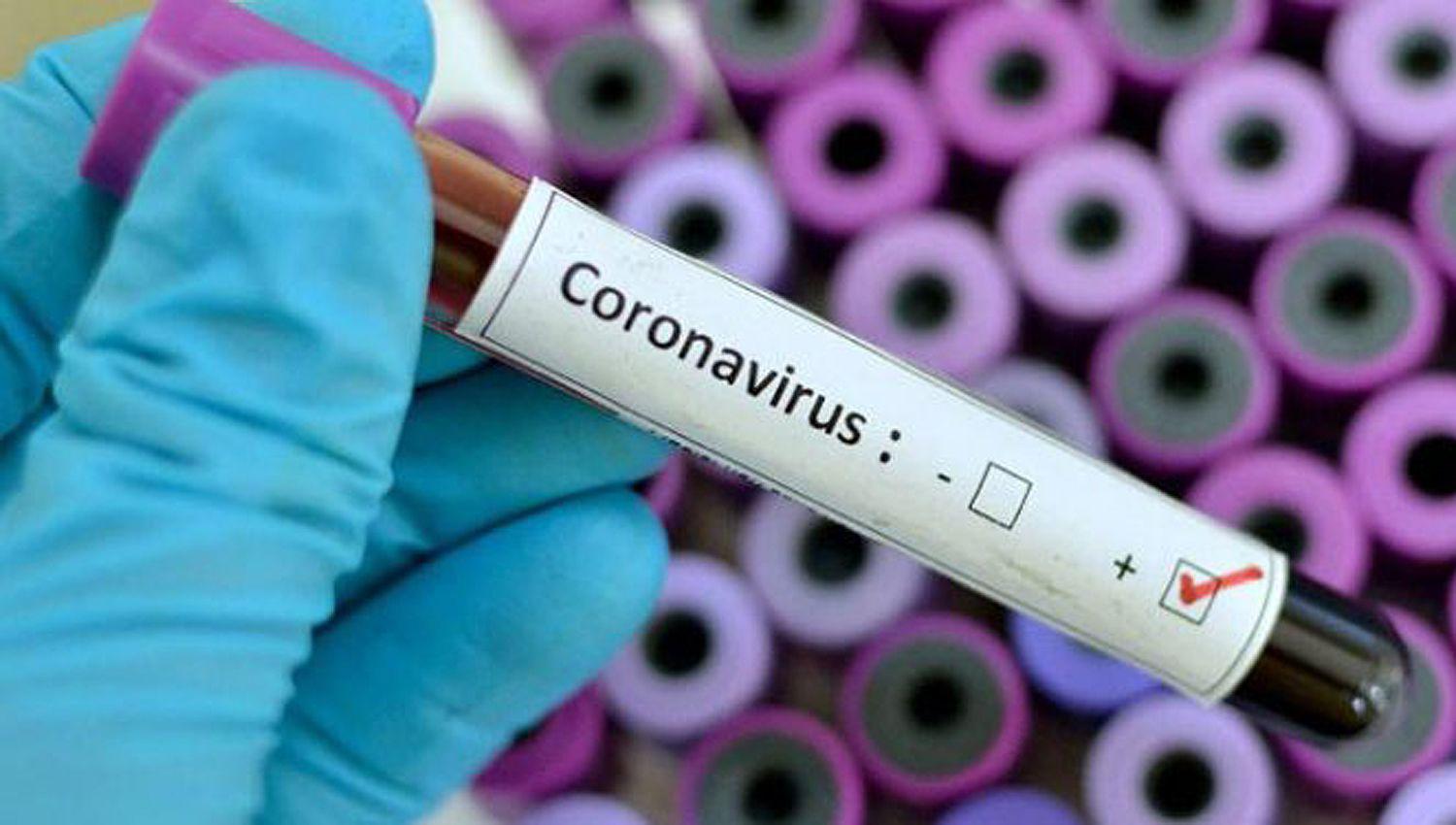 Confirmaron el primer caso de coronavirus en la Argentina