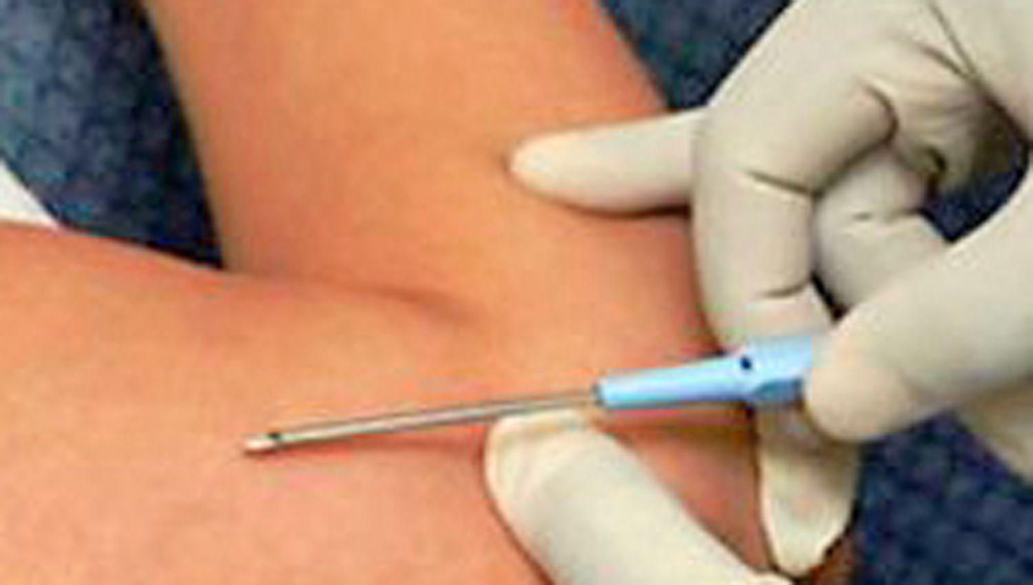 Colocaraacuten gratis los implantes subdeacutermicos anticonceptivos en la UPA del barrio Almirante Brown