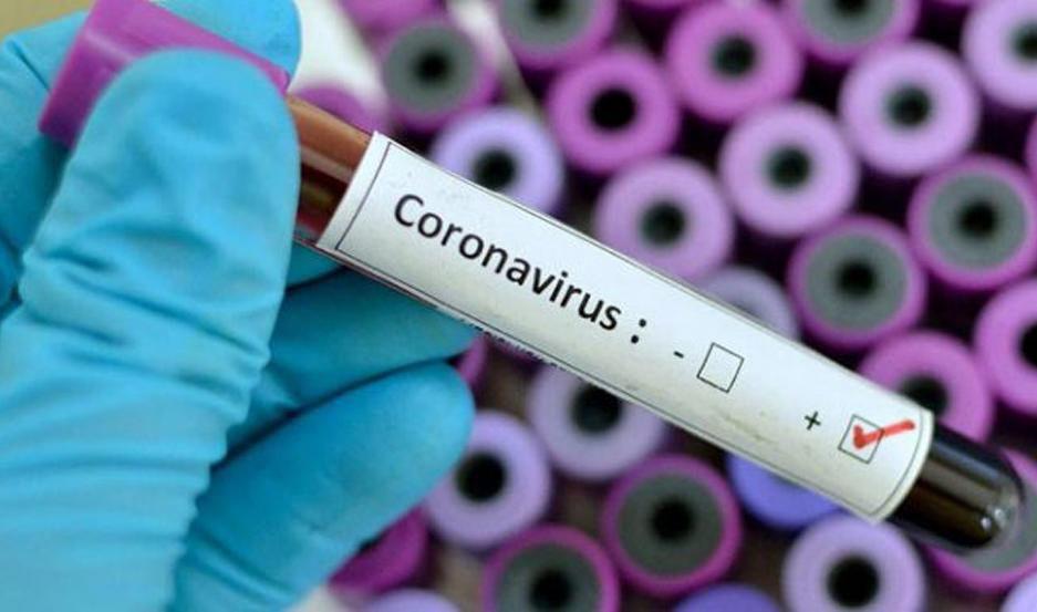 Coronavirus en Argentina- dos muertos 34 casos confirmados y uno dado de alta