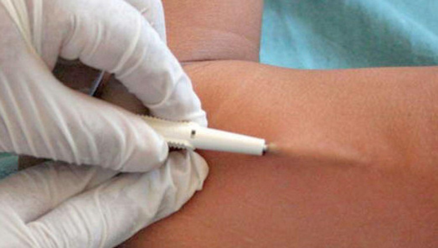 El mieacutercoles colocaraacuten implantes subdeacutermicos anticonceptivos