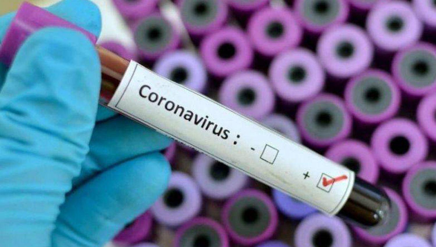 Confirmaron el primer caso de coronavirus 100 por ciento local en la Argentina