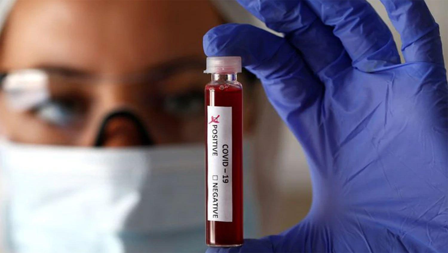 La sangre de los que superaron el coronavirus podriacutea servir para la cura