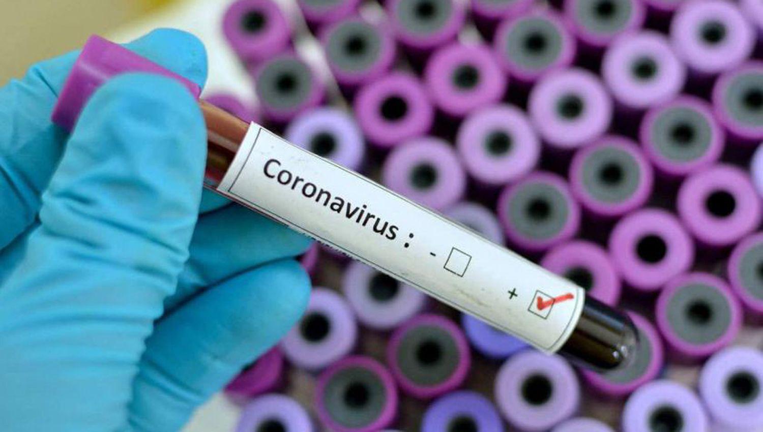 Coronavirus en Argentina- confirman otras 4 muertes y se elevan a 105 los fallecidos