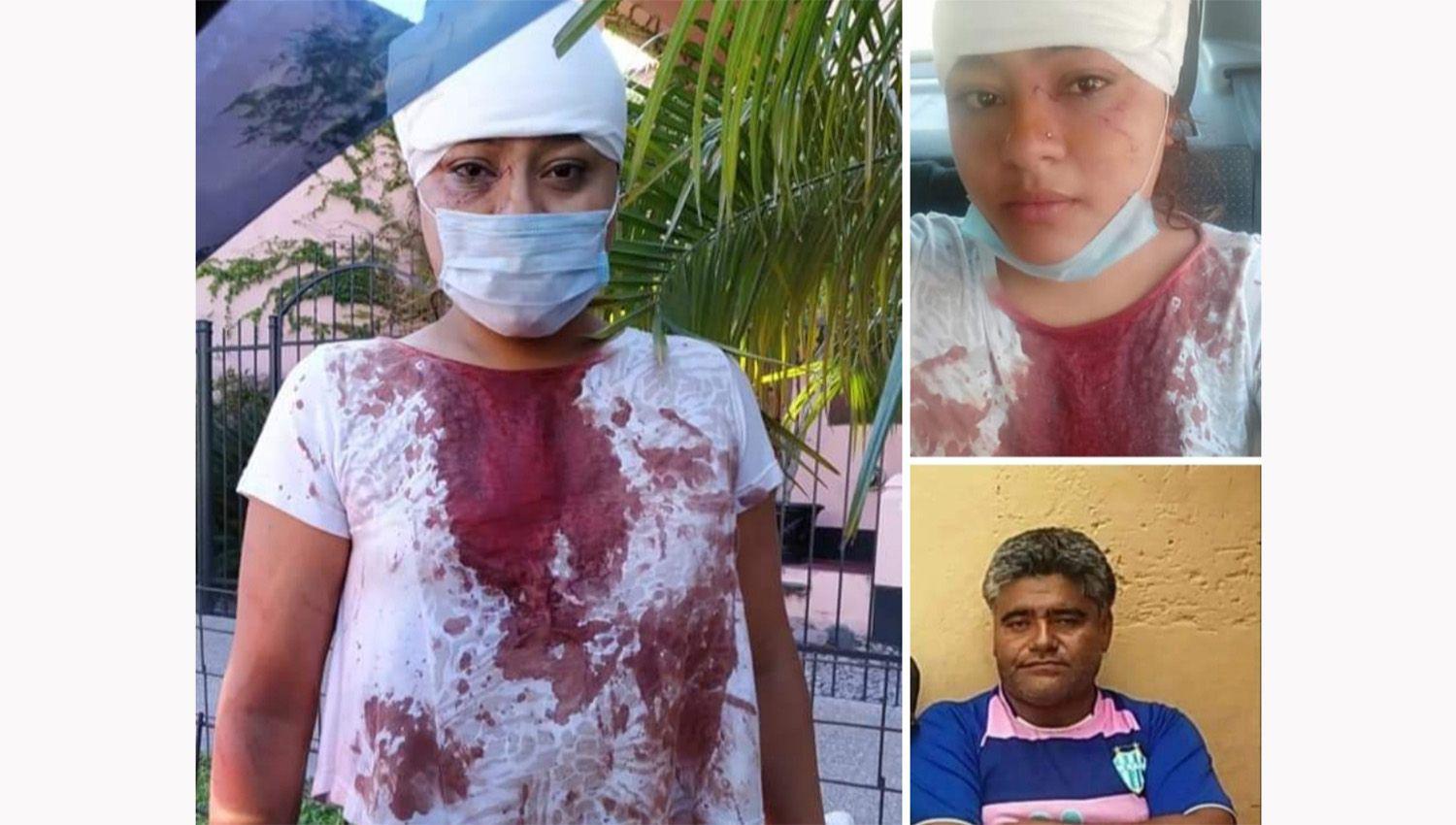 Una joven acusoacute a su tiacuteo de una salvaje agresioacuten con una botella de vino