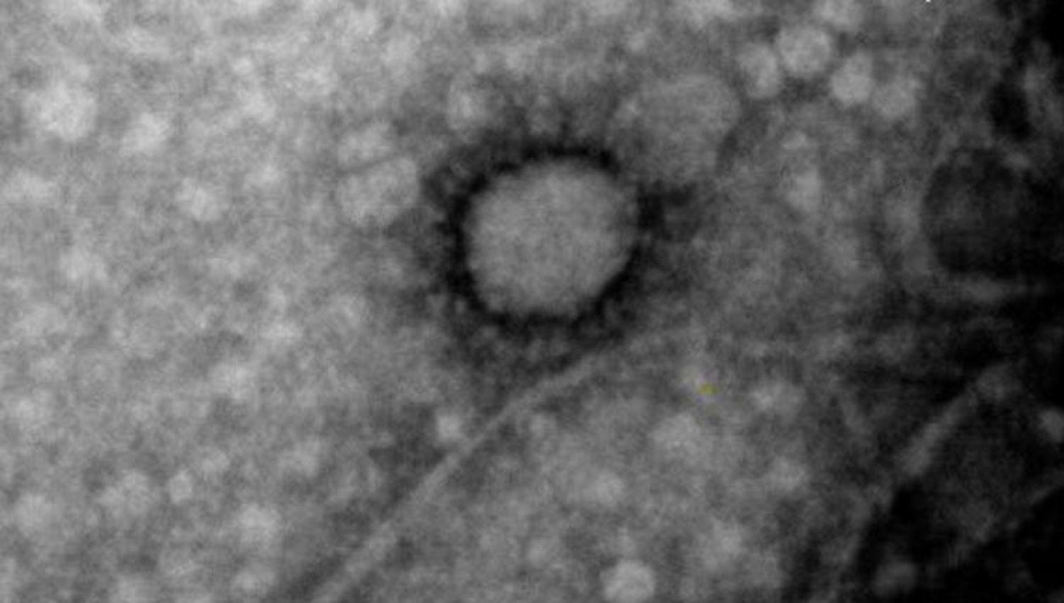 Cientiacuteficos lograron fotografiar la cepa de coronavirus que circula en el paiacutes
