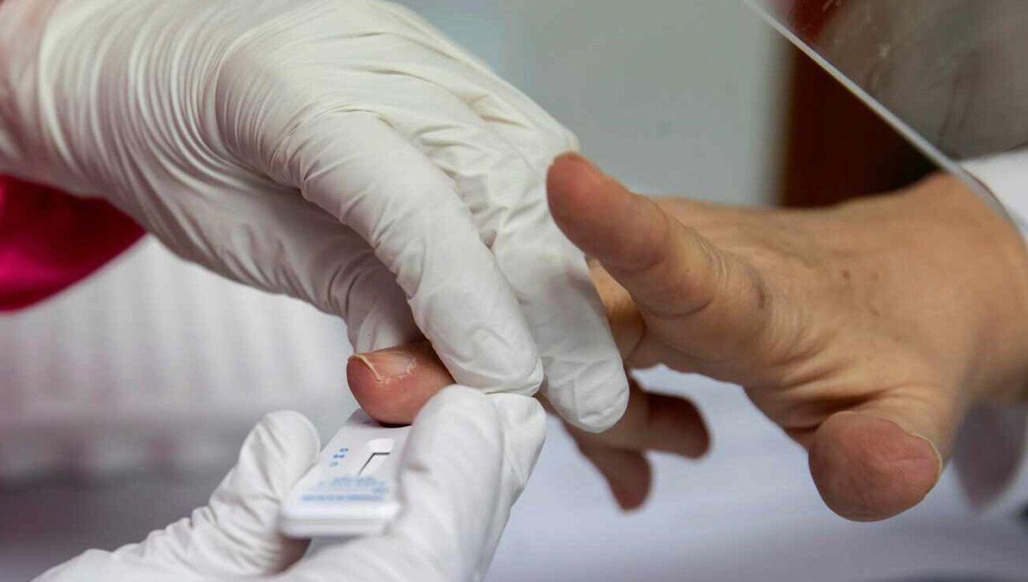 Anmat aproboacute test de diagnoacutestico raacutepido de coronavirus desarrollado por un grupo de cientiacuteficos argentinos