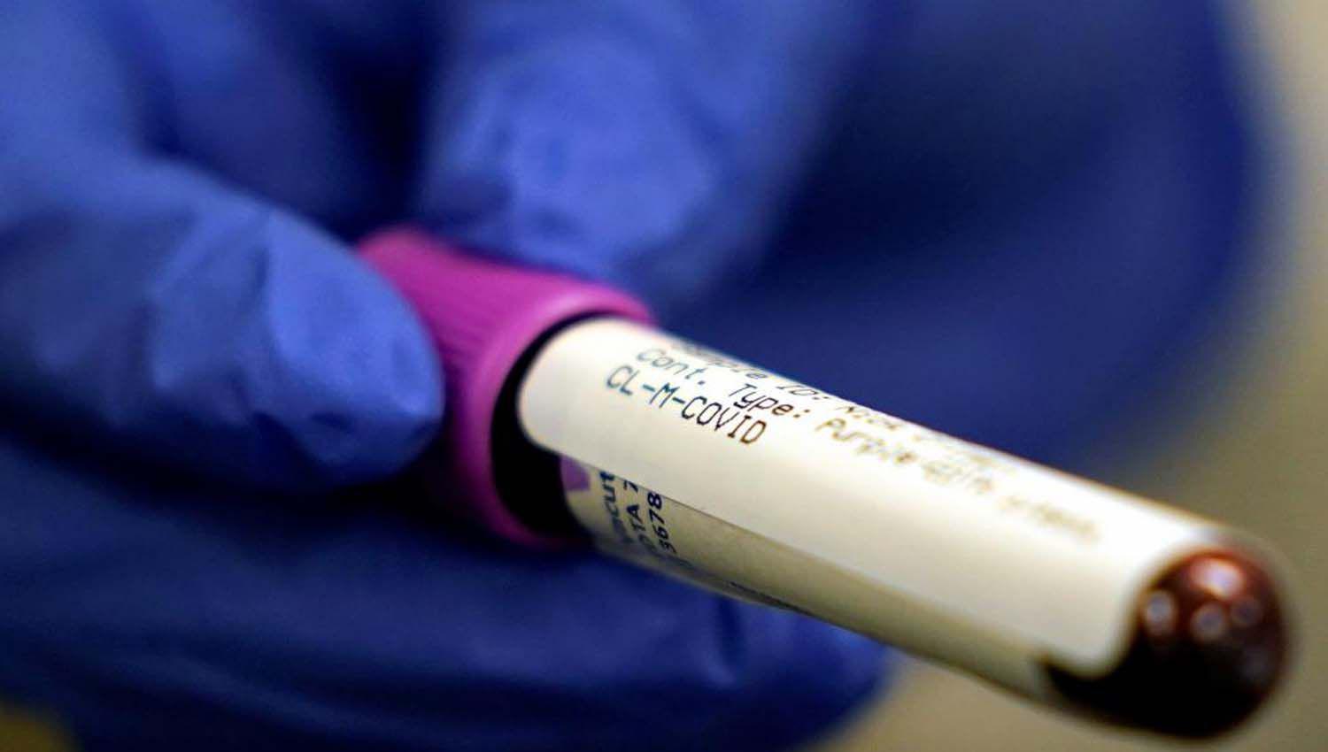 Coronavirus en Argentina- 34159 casos en total y 886 muertes