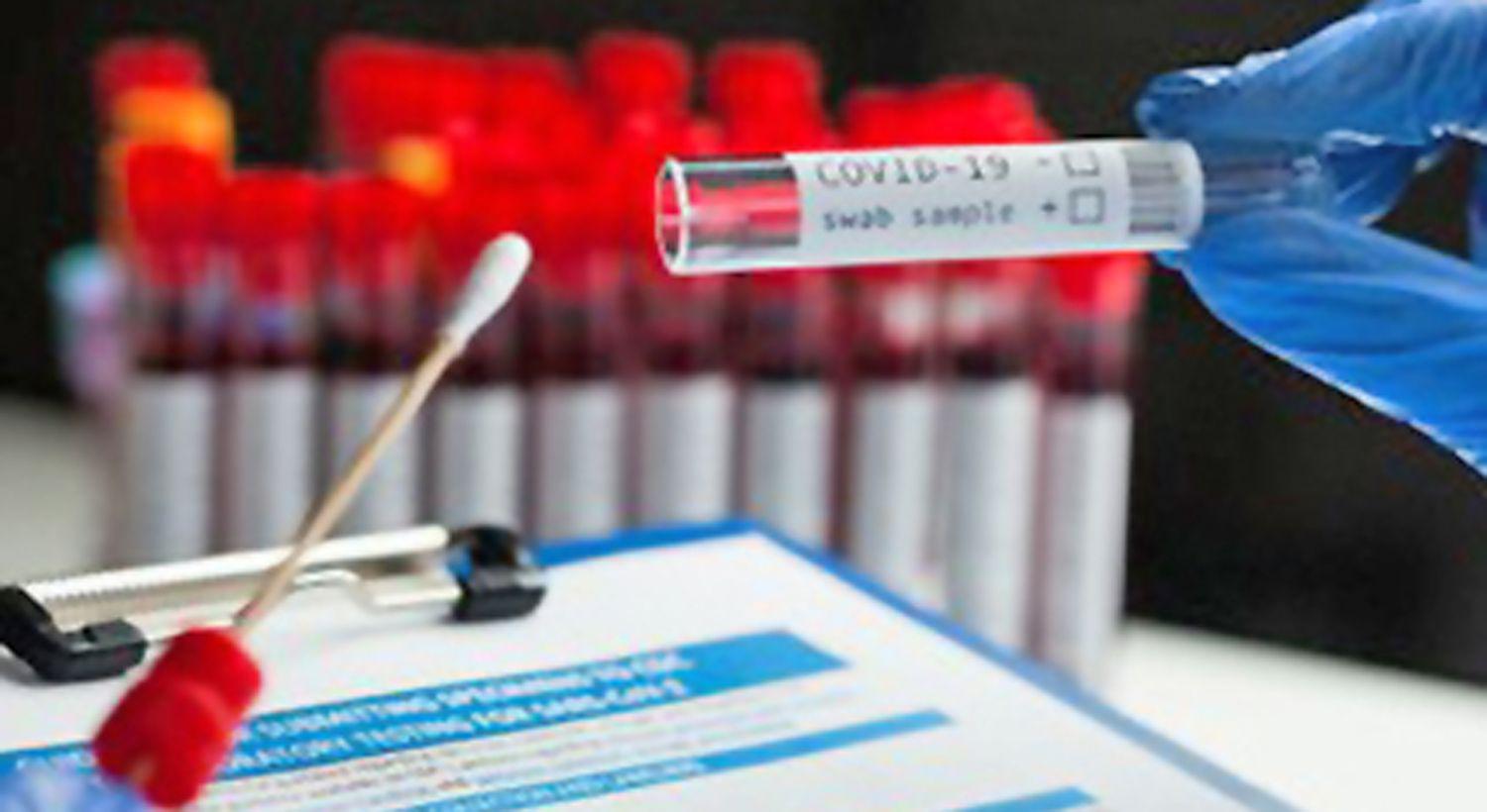 Aprueban el primer test argentino de diagnoacutestico para coronavirus