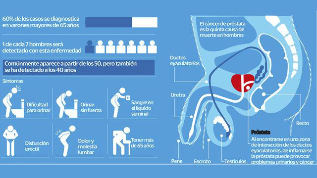 Recomiendan controles para prevenir el caacutencer de proacutestata