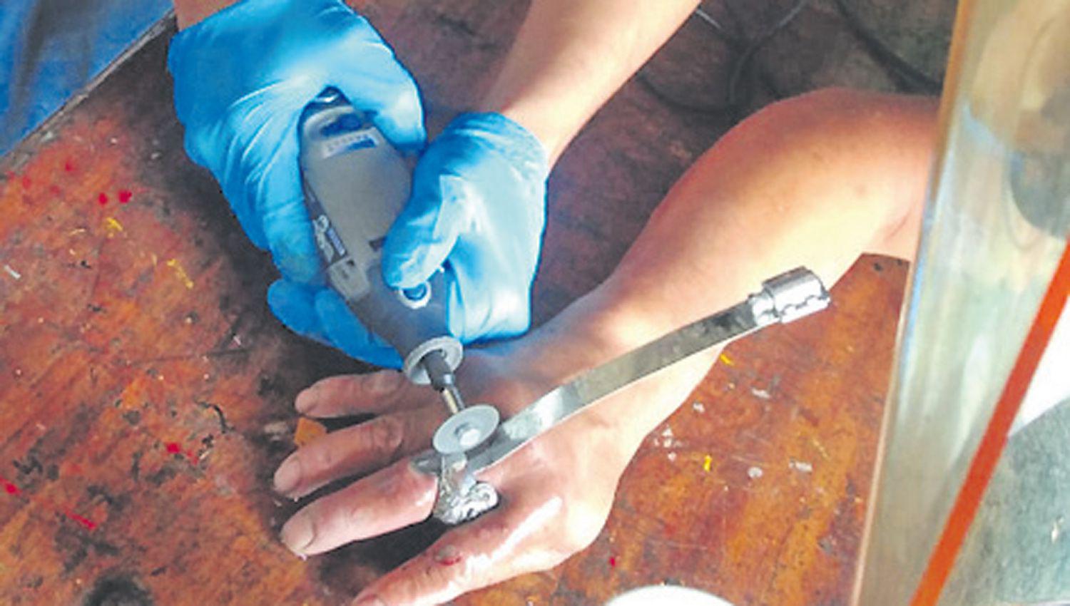 Bomberos auxiliaron a una mujer que teniacutea un anillo atorado en su dedo anular y tuvieron que cortarlo