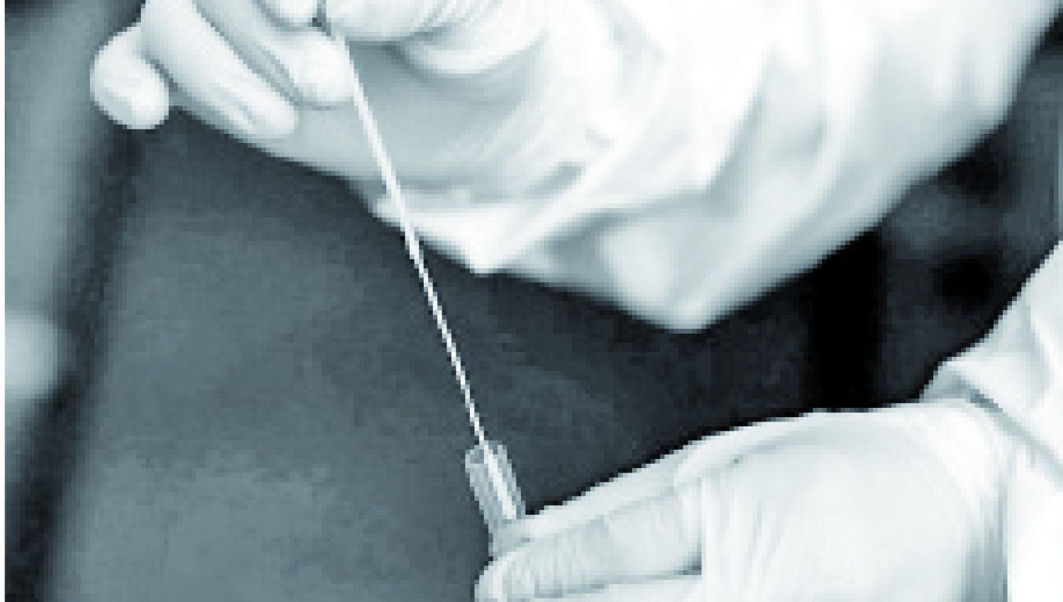 Hisopados- iquestCuaacutendo se  realizan gratuitamente