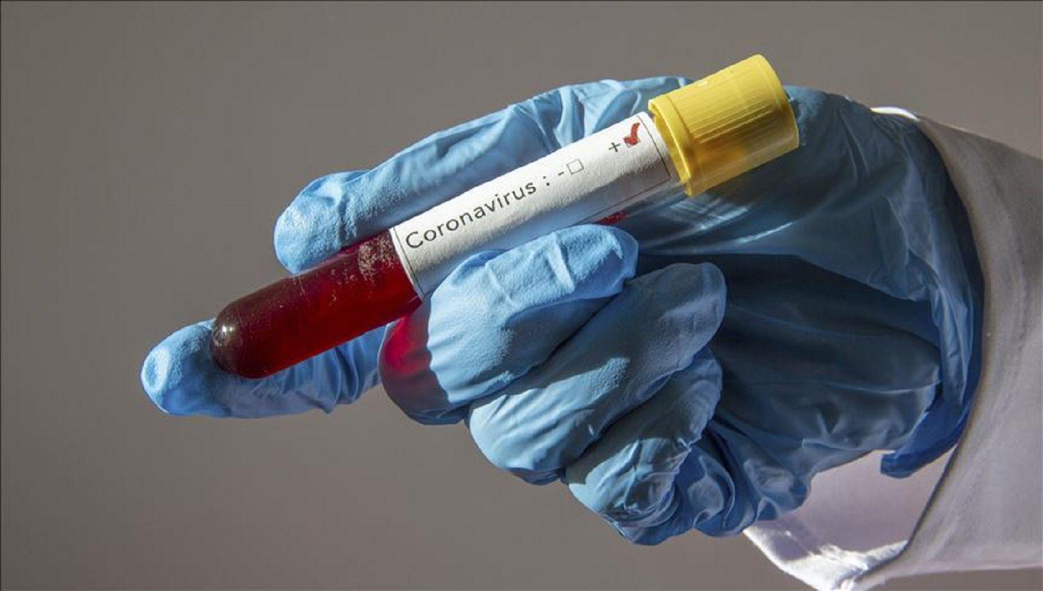 Santiago del Estero tuvo 72 casos de coronavirus este domingo