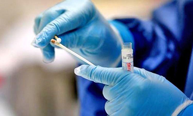 Lugares en los que se puede solicitar turno para realizar los hisopados