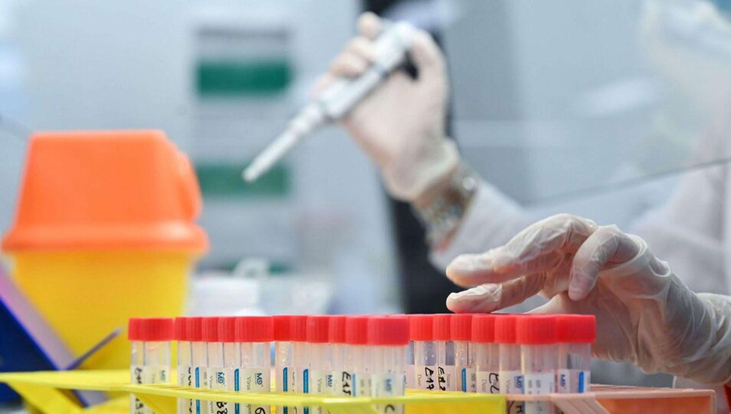 Detectaron el primer caso de la variante Mu en el paiacutes