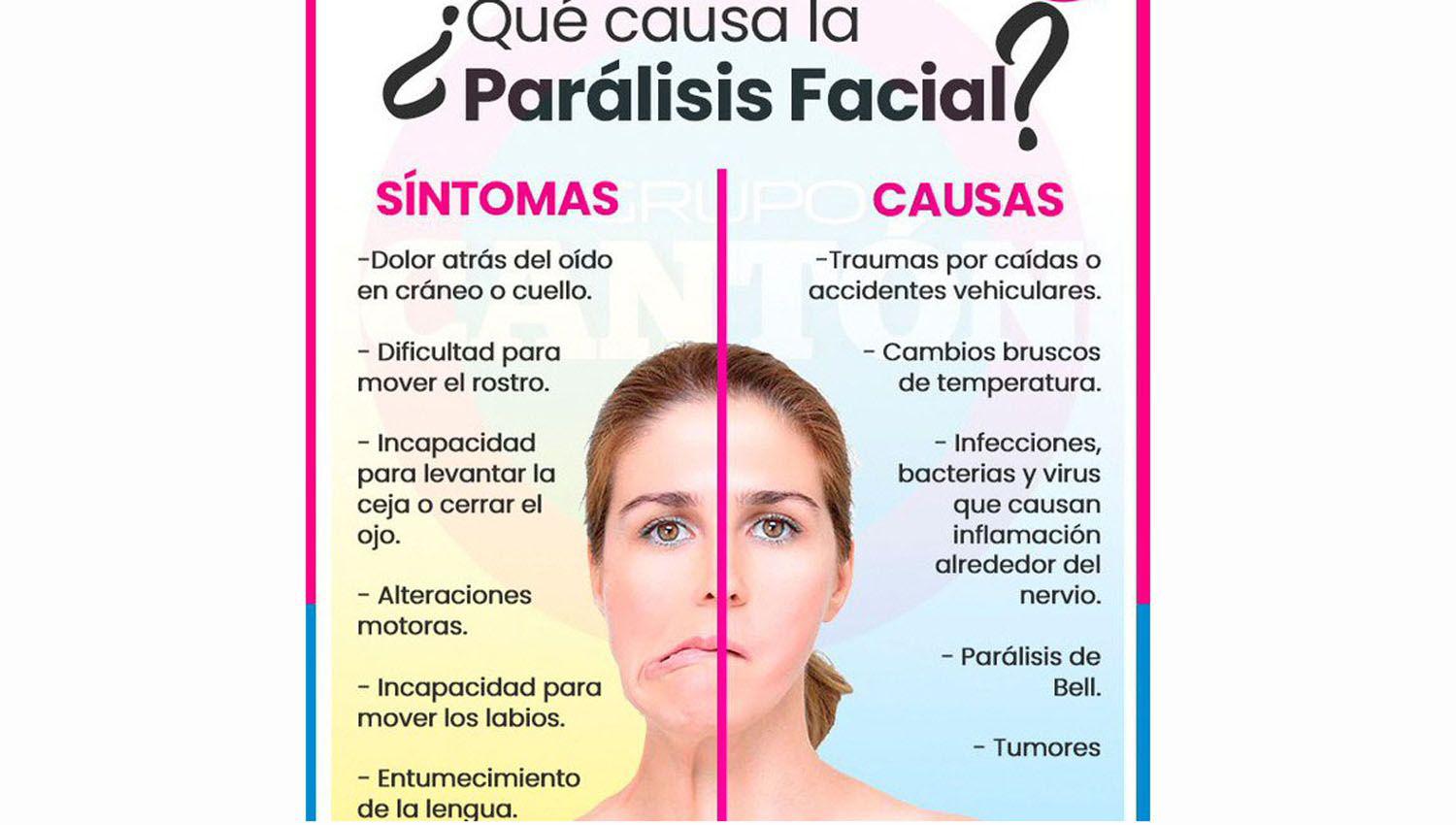 El daño ocurre cuando una persona no puede mover alguno o ning�n m�sculo en uno o ambos lados de la cara