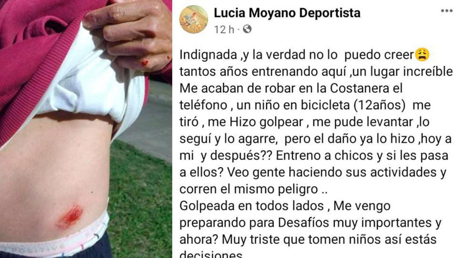 La víctima contó lo sucedido en su perfil de la cuenta de Facebook Se mostró indignada