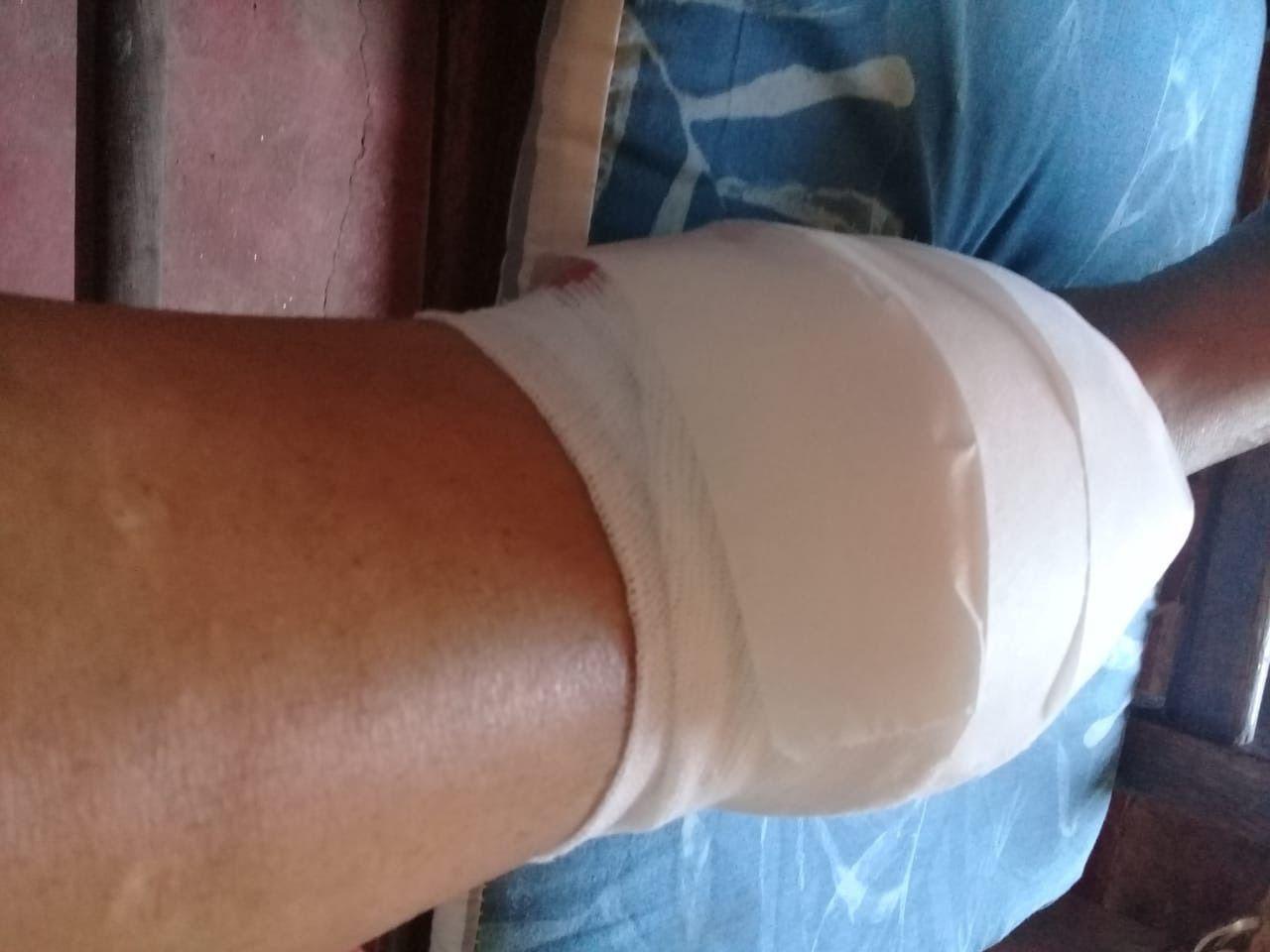 Una mujer fue atacada por su propio perro- la familia lo sacrificoacute