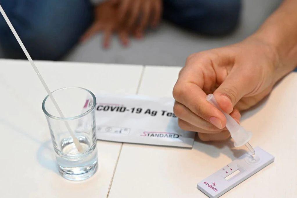 La ANMAT aproboacute los autotest de coronavirus