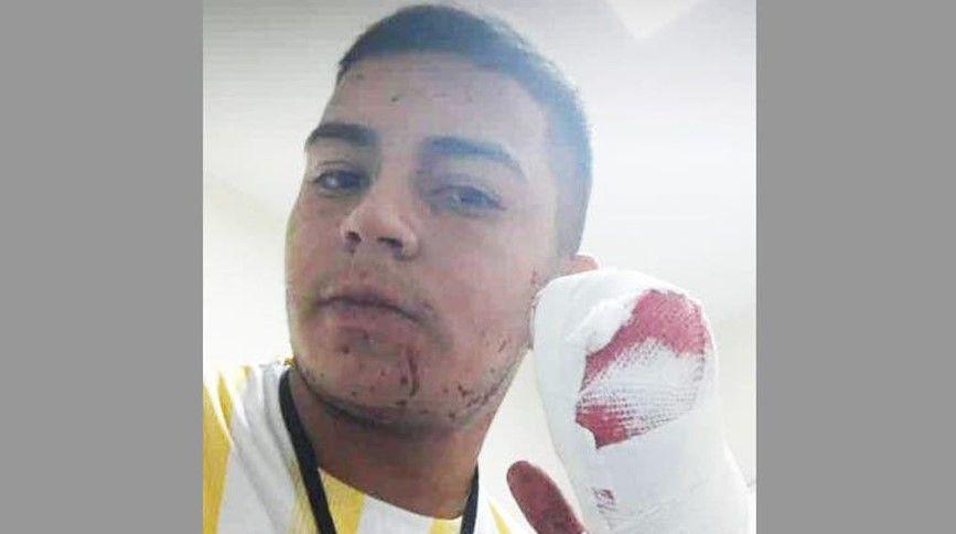 Un joven de 22 antildeos fue detenido por el brutal asalto a un cadete al que le cortoacute cuatro dedos de una mano