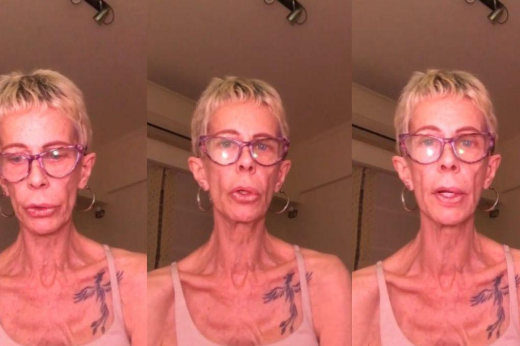 ldquoMuelas de vacardquo- la afeccioacuten que padece Mariacutea Valenzuela y por la cual no puede ingerir alimentos