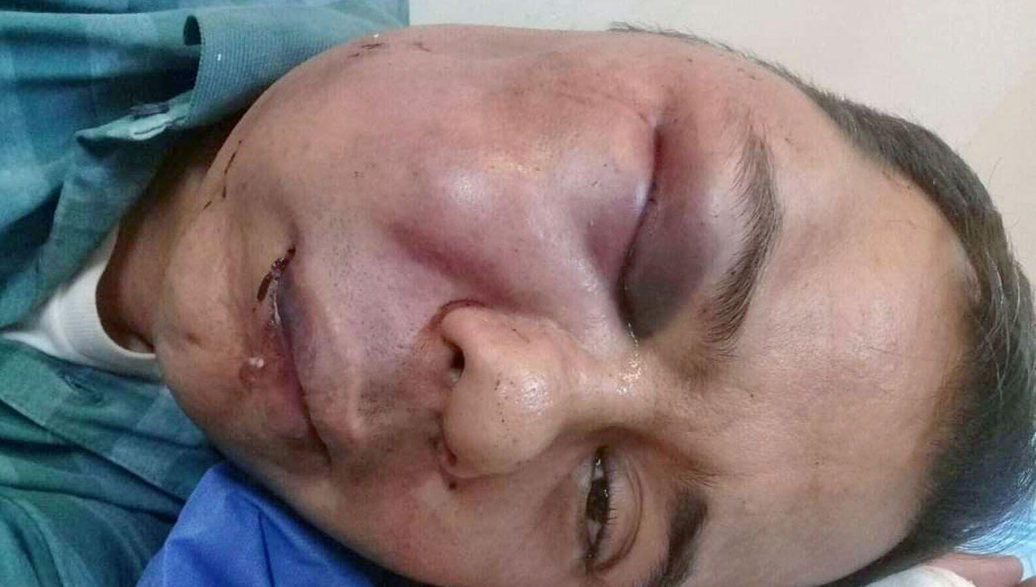 Conocido profesor y periodista recibioacute brutal golpiza tras robo