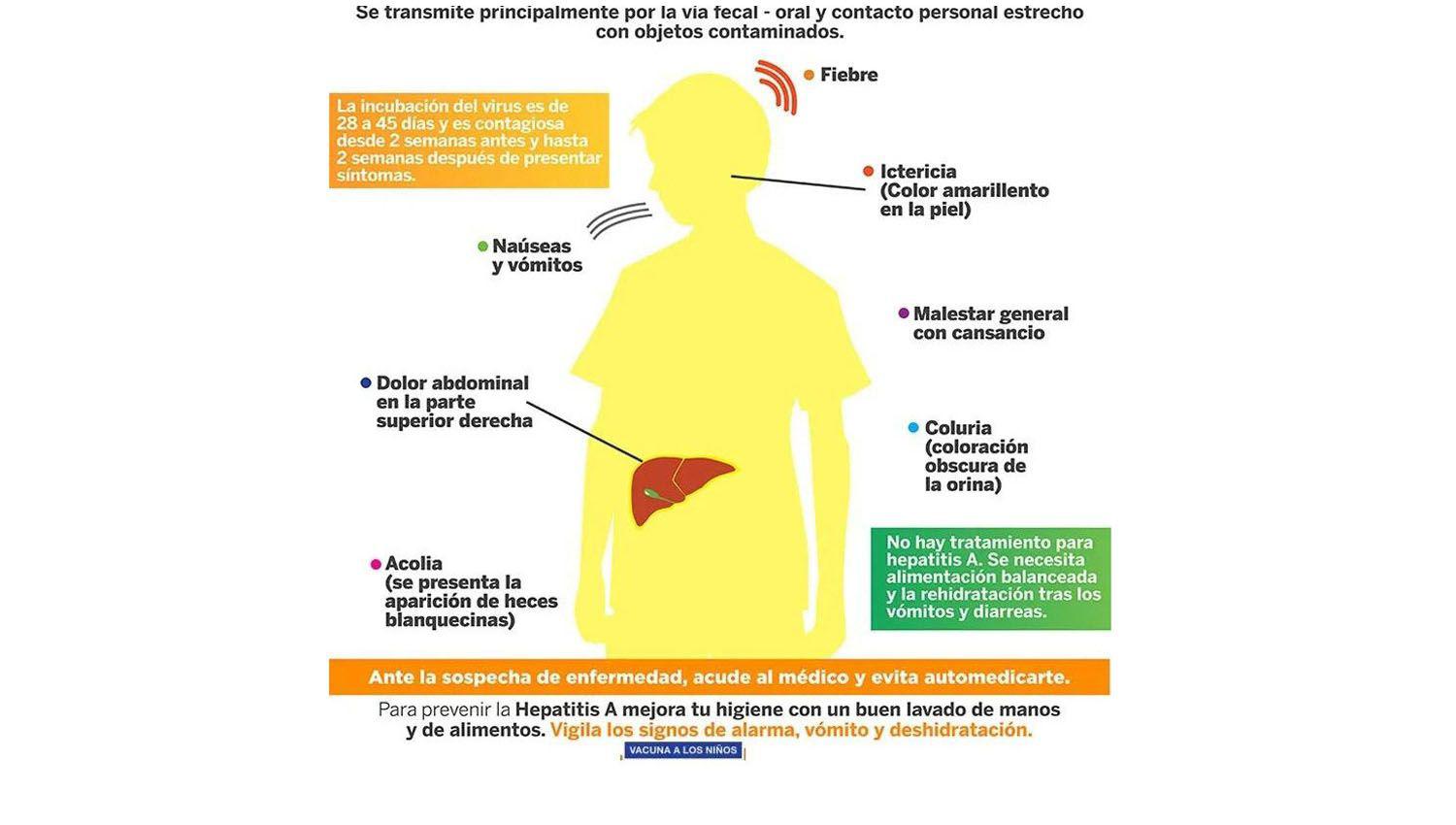 Preocupa a pediatras locales la aparicioacuten de un tipo de hepatitis aguda de origen desconocido