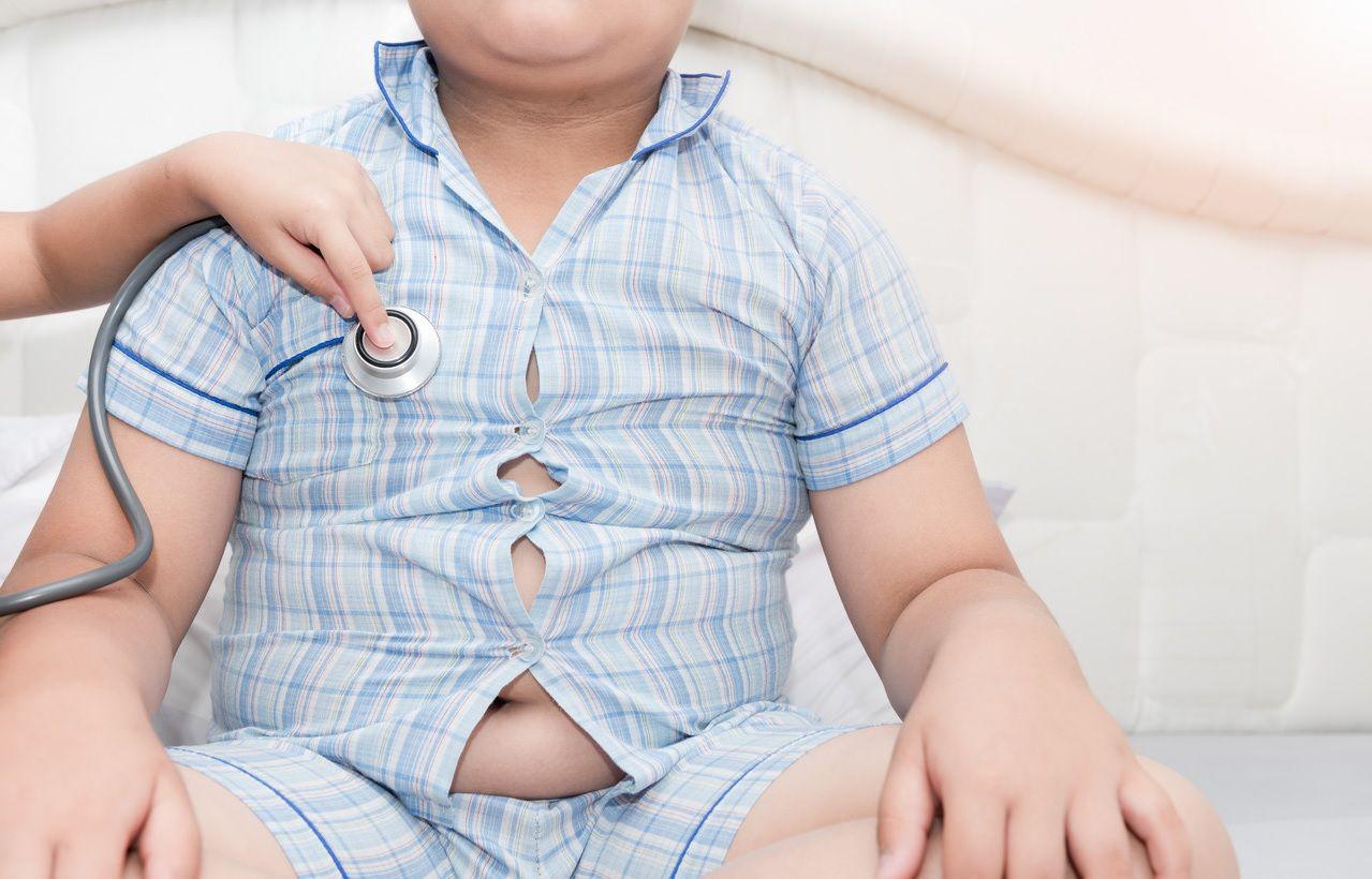 Obesidad infantil una epidemia que avanza