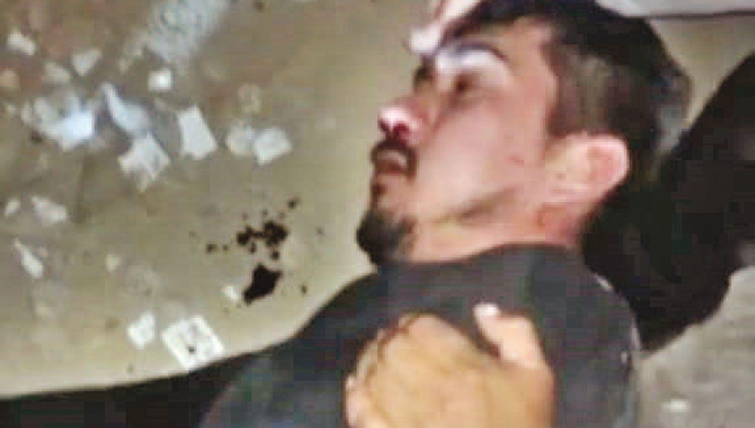 Otro joven en grave estado tras ser atacado por patovicas