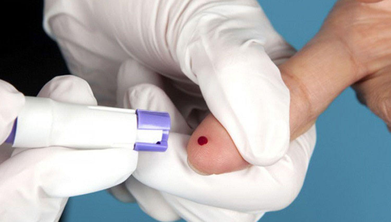 Crece el nuacutemero de casos de Siacutefilis en la Argentina