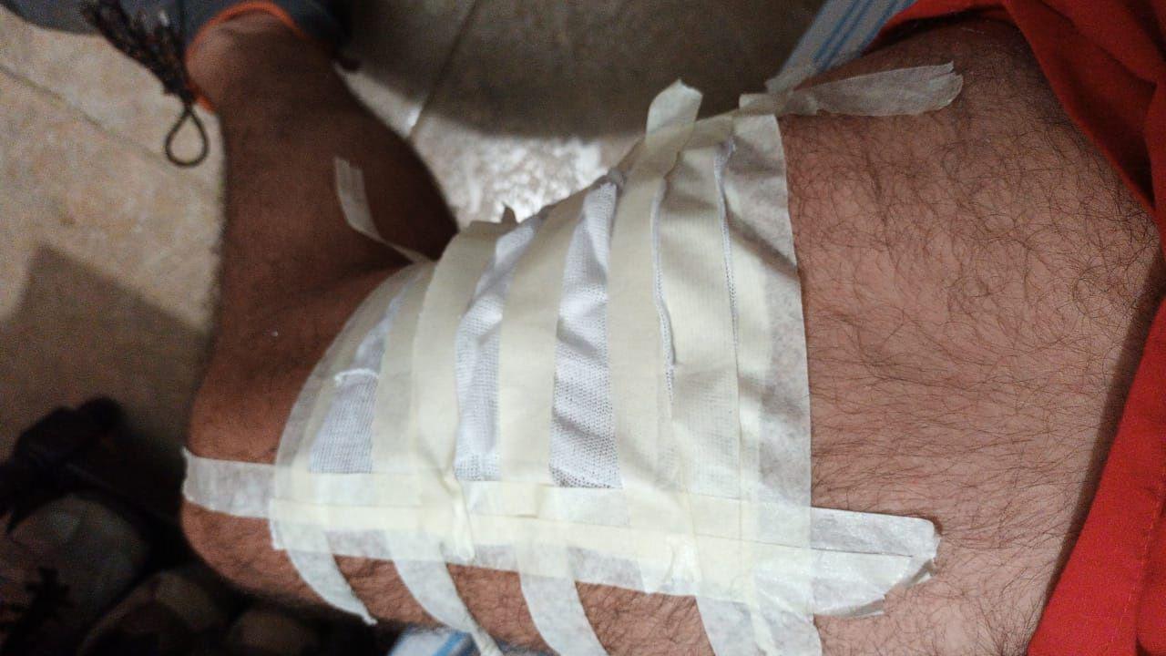 Pitbull muerde a un fiscal y sus duentildeas terminan imputadas