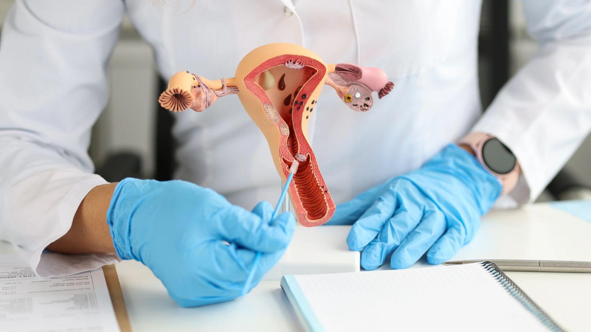 Caacutencer de uacutetero- soacutelo el 12-en-porciento- de las nintildeas se vacuna contra VPH