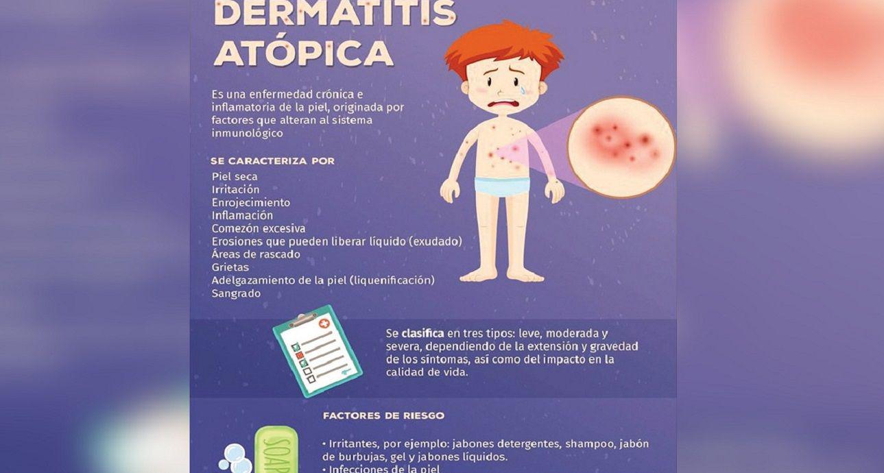 Dermatitis atoacutepica- existe una poblacioacuten pediaacutetrica significativa que no logra controlarlo
