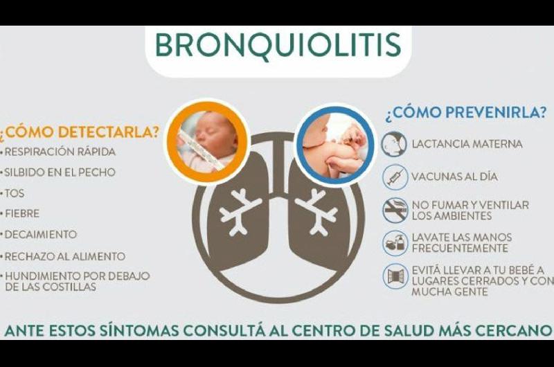 Informe de Salud reveloacute que el brote de bronquiolitis en el paiacutes superoacute en casi un 85-en-porciento- a los niveles prepandeacutemicos