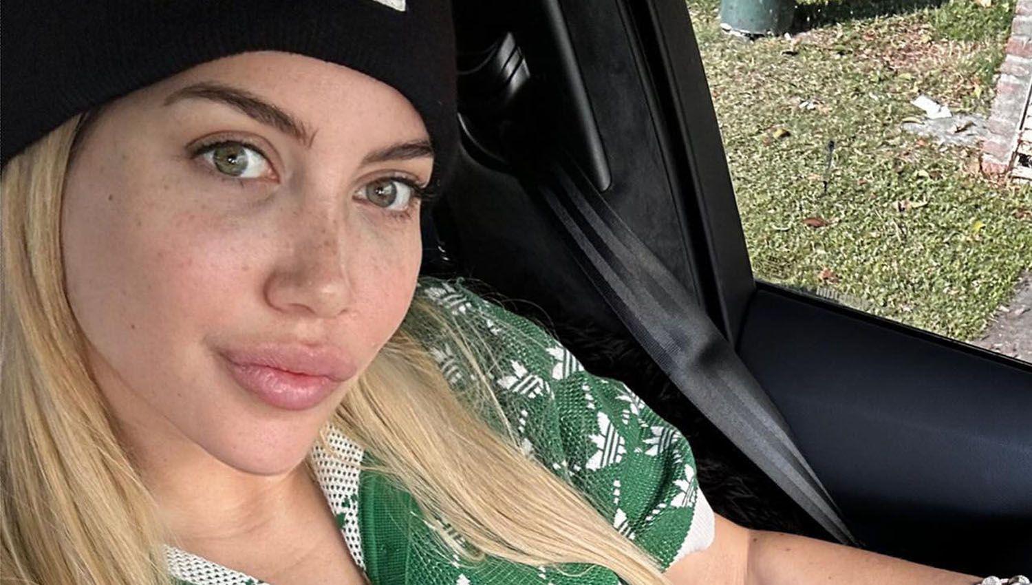 Wanda Nara confirma que espera resultados cliacutenicos