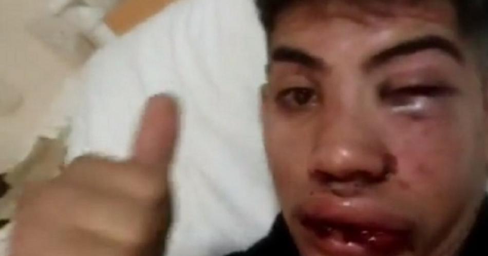 VIDEO Desfiguraron a un joven por una pelea de traacutensito y quedoacute registrado
