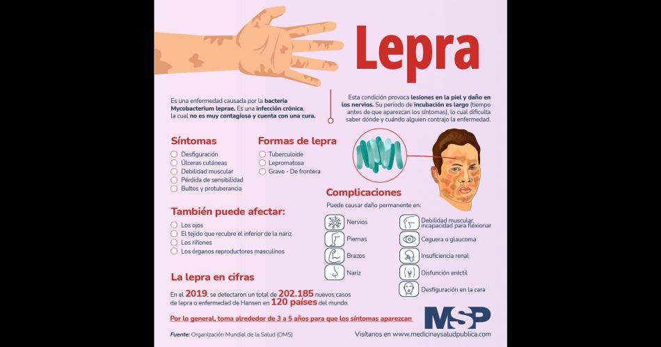 La lepra no estaacute erradicada y se debe prevenir