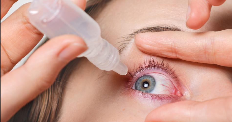 iquestHay relacioacuten entre la deshidratacioacuten y sequedad ocular 