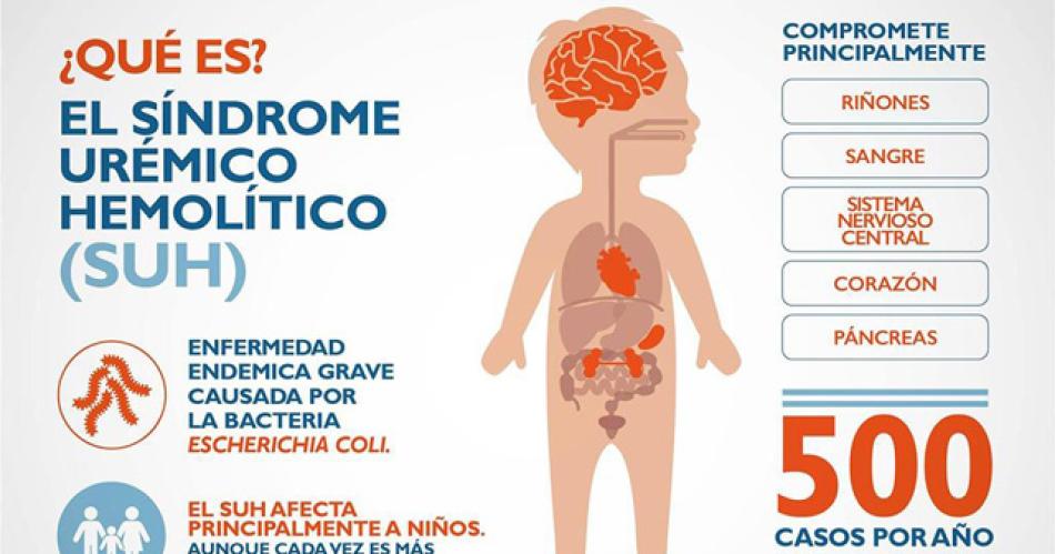 Por el incremento de casos de Siacutendrome Ureacutemico Hemoliacutetico piden extremar cuidados