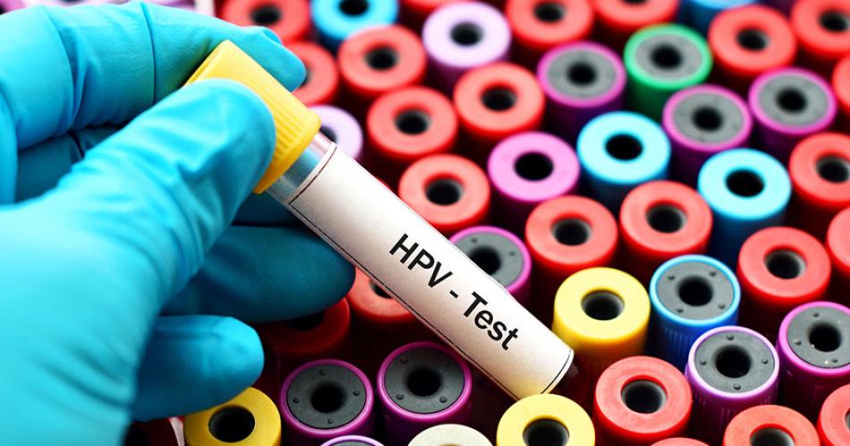 La deteccioacuten temprana es clave para evitar el caacutencer de cuello uterino