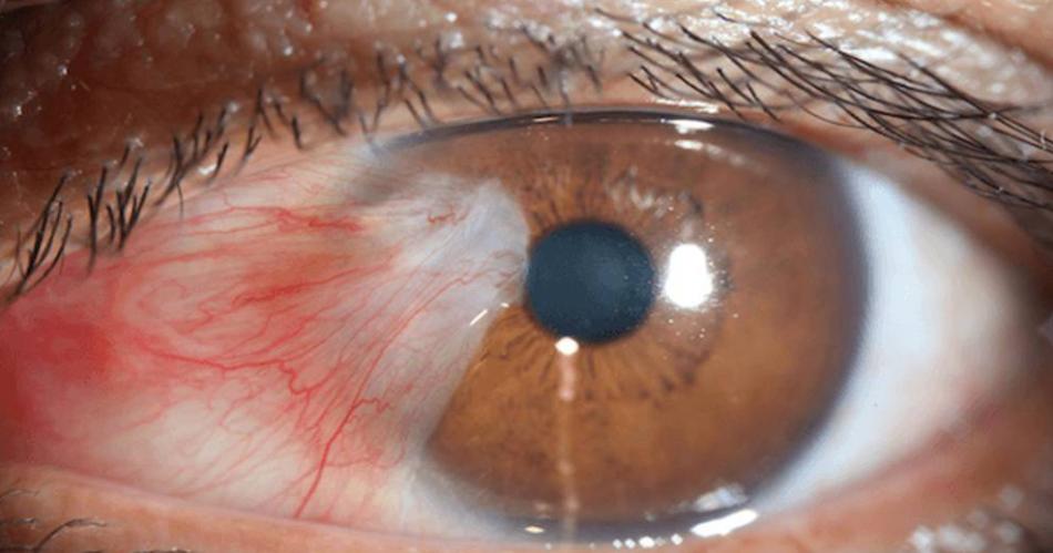 Haacutebitos que atentan contra la salud de tus ojos