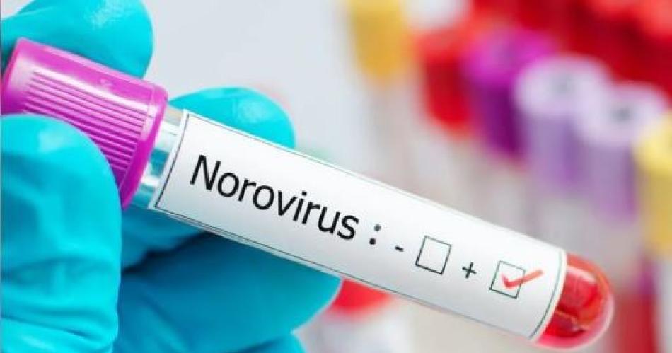Alarma en Argentina por un brote de norovirus- queacute es y coacutemo se contagia