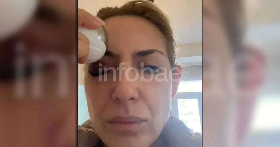 VIDEO Filtran imaacutegenes de Fabiola Yantildeez curaacutendose un ojo morado
