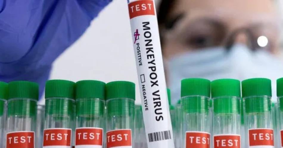 Detectan siete nuevos casos de viruela del mono en Argentina- ya son 32 en el paiacutes