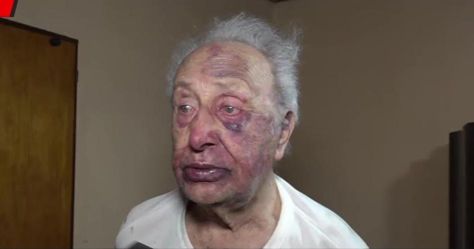 VIDEO Jubilado de 88 antildeos recibioacute una brutal paliza- le robaron 400 mil pesos y 7 mil doacutelares