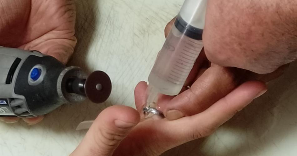 Asistieron a una mujer con un anillo atorado en su dedo y montaron un delicado procedimiento