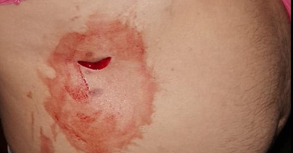 Una pelea entre dos parejas terminoacute con un hombre acuchillado