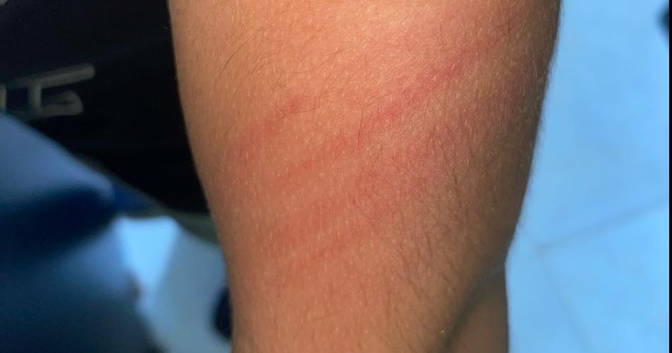 Mujer atacoacute a su hijo de 6 antildeos salvajemente y fue denunciada