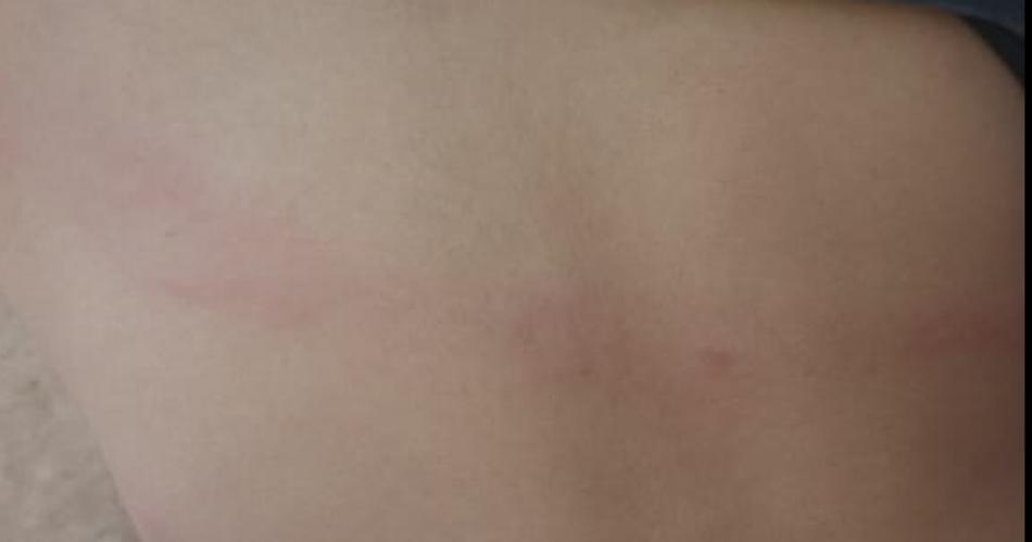 Mujer atacoacute a su hijo de 6 antildeos salvajemente y fue denunciada